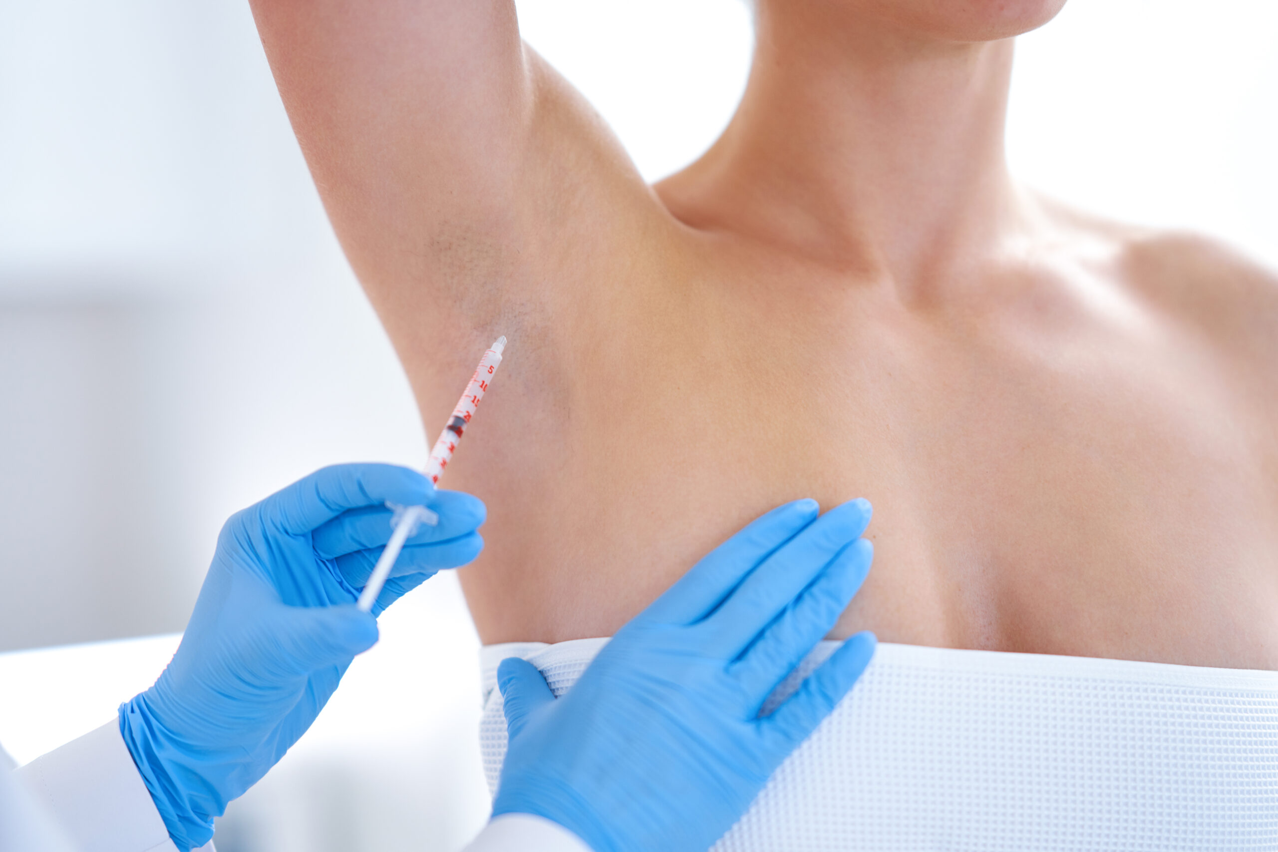 Svedbehandling med botox i RIngsted